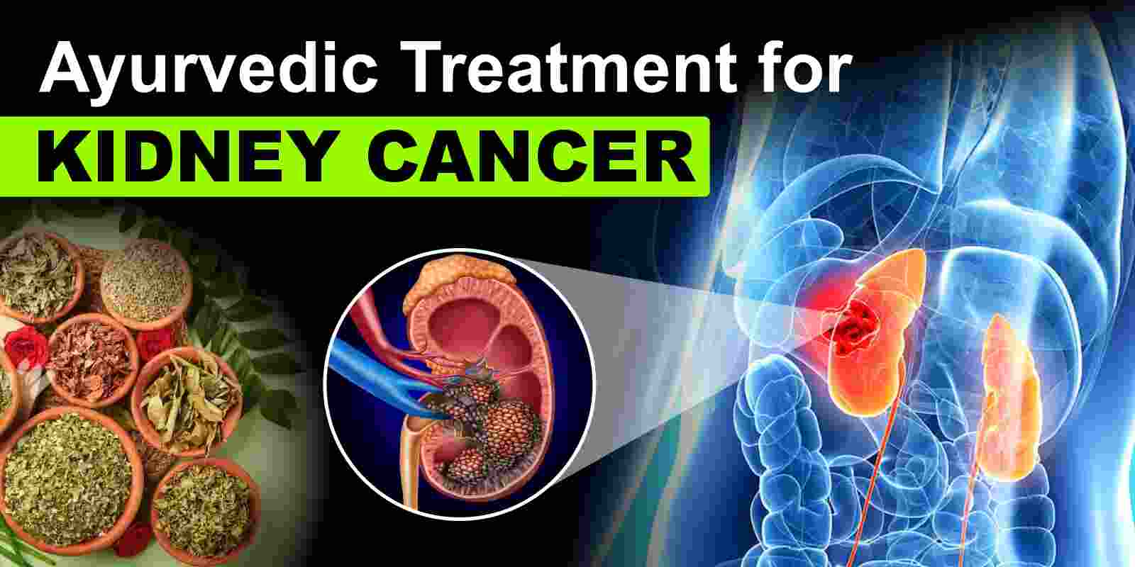 Ayurvedic Treatment for Kidney Cancer